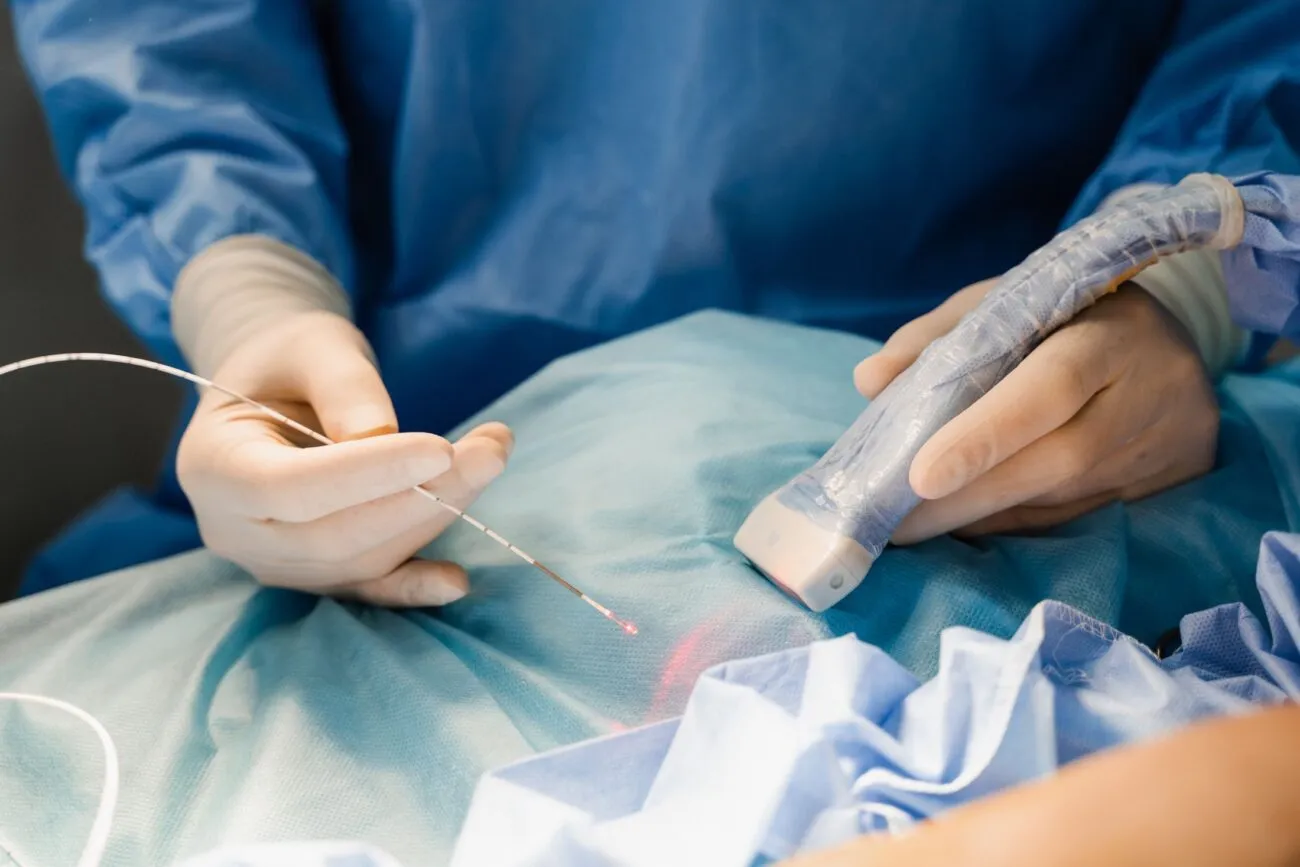 Endovenous laser therapy